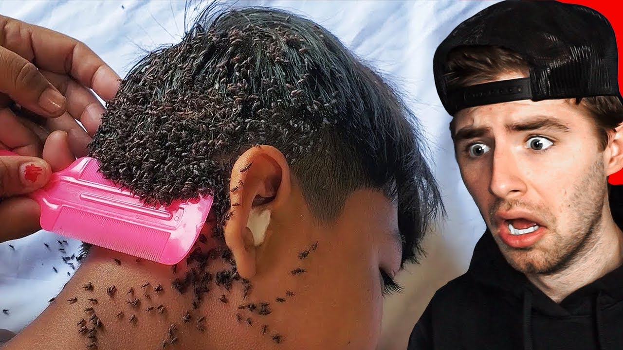 these bugs wont stop biting me..