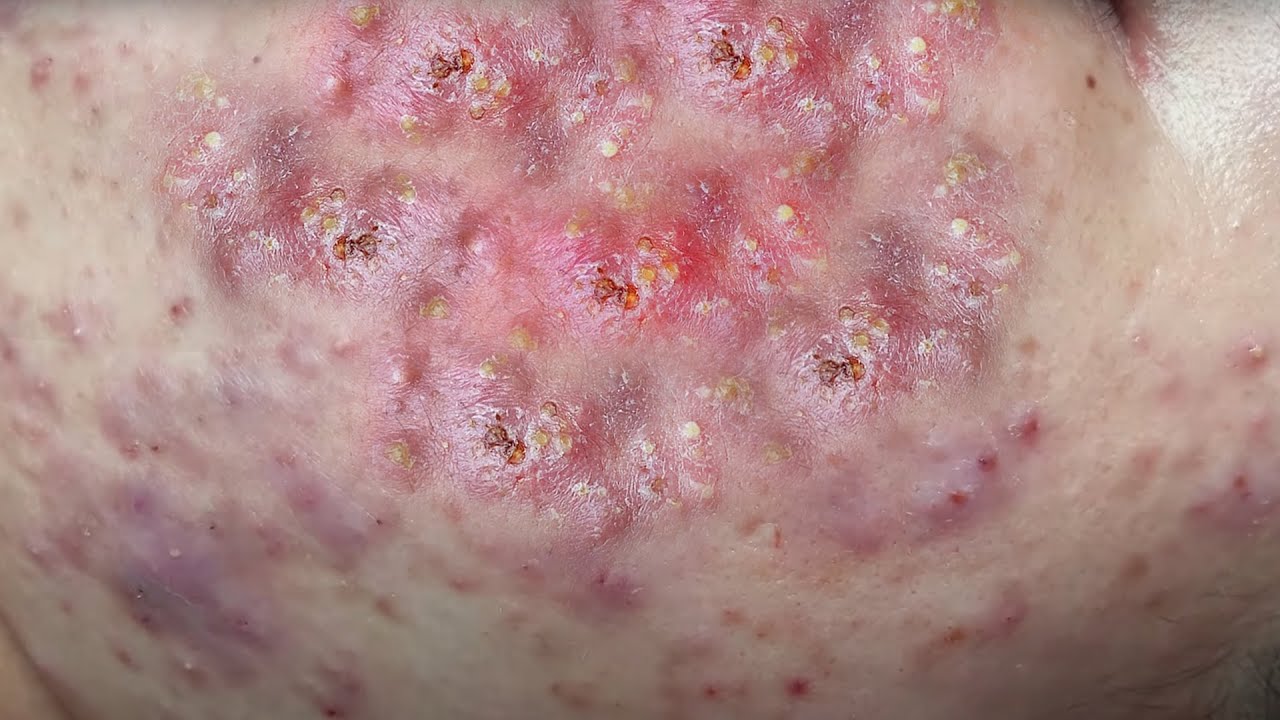 Make Your Day Relaxing With Linh Mun | LM15