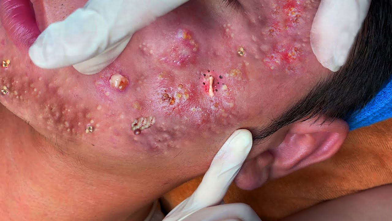 Make Your Day Relaxing With Linh Mun | LM17