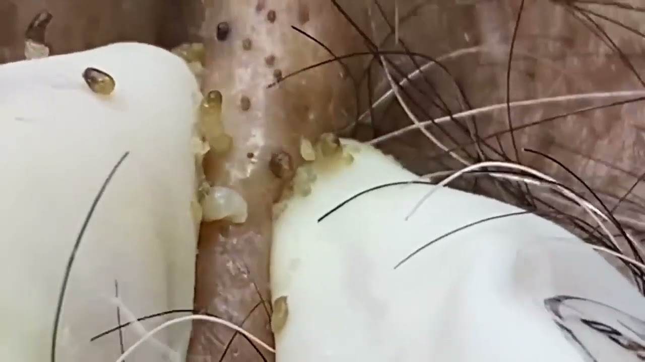 Make Your Day Relaxing With Linh Mun   LM003