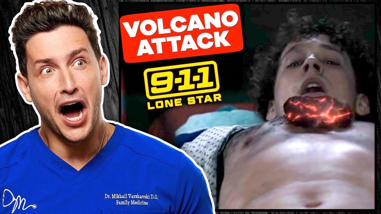 Doctor Reacts To 9-1-1 Lone Star Medical Emergencies