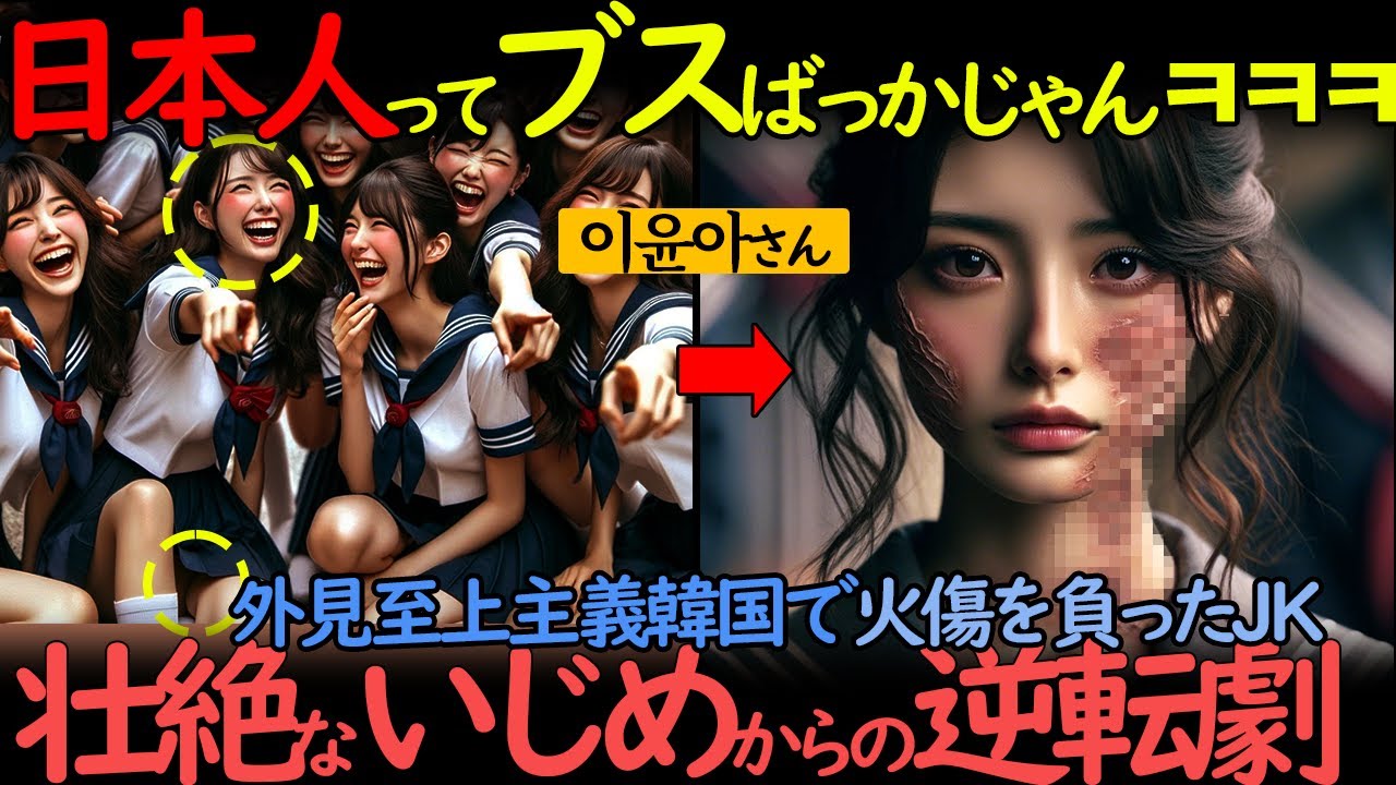 外見至上主義の韓国で顔に傷を負うとどうなるのか？【海外の反応】