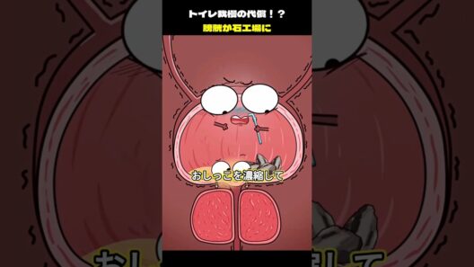 トイレ我慢の代償!?  膀胱が石工場に!